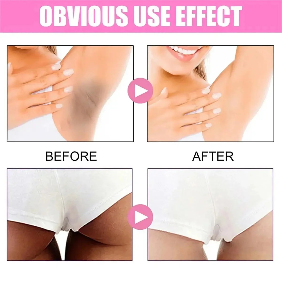 Fast Whitening Dark Knuckles B - Korean Skincare Routine ulasan dan harga